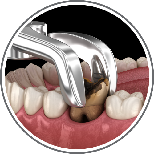 oral surgery and tooth extractions
